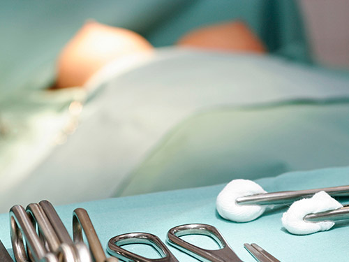 手術のリスク 手術のリスク