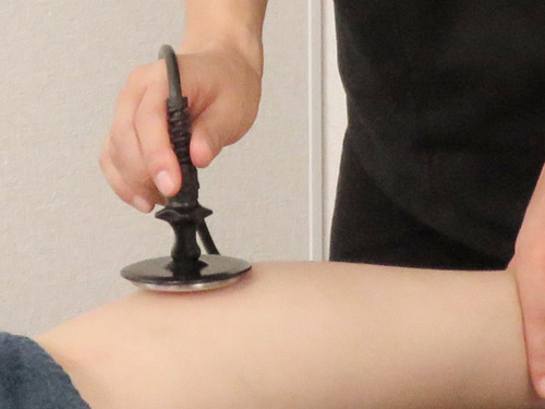 高周波温熱療法 高周波温熱療法